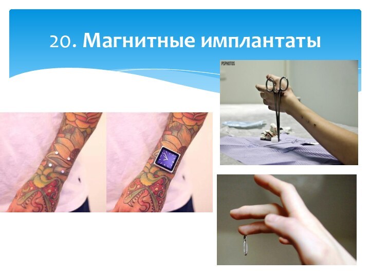 20. Магнитные имплантаты