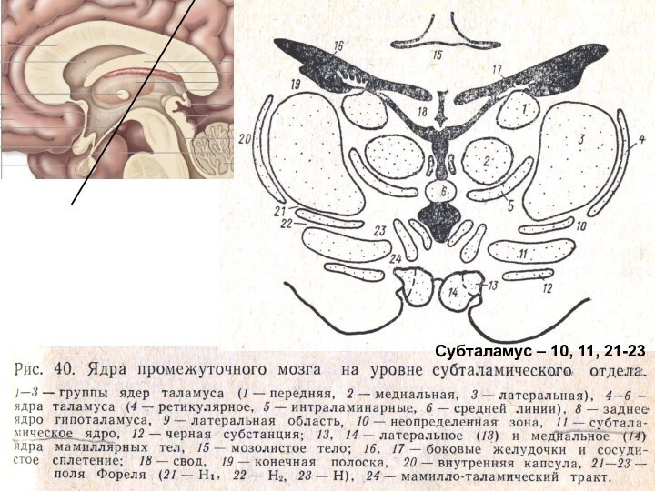 Субталамус – 10, 11, 21-23