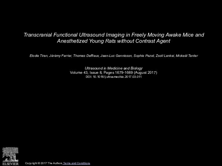 Transcranial Functional Ultrasound Imaging in Freely Moving Awake Mice and Anesthetized Young