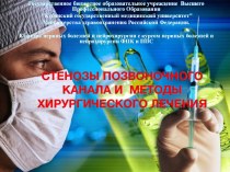 Стенозы позвоночного канала и методы хирургического лечения