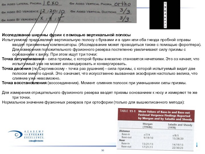 Исследование ширины фузии с помощью вертикальной полосыИспытуемому предъявляют вертикальную полосу с буквами