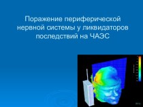 Поражение периферической нервной системы у ликвидаторов последствий на ЧАЭС