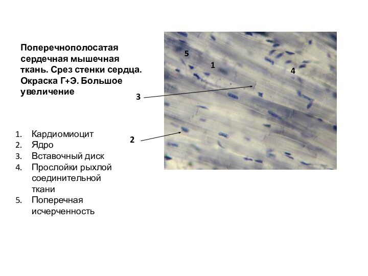 Поперечнополосатая сердечная мышечная ткань. Срез стенки сердца. Окраска Г+Э. Большое увеличениеКардиомиоцитЯдроВставочный дискПрослойки рыхлой соединительной тканиПоперечная исчерченность15234
