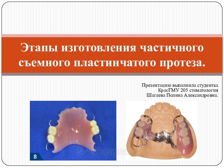 Презентацию выполнила студентка  КрасГМУ 205 стоматология Шагаева Полина Александровна.Этапы изготовления частичного съемного пластинчатого протеза.