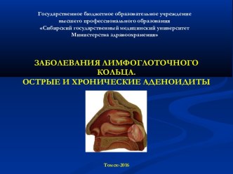 Заболевания лимфоглоточного кольца. Острые и хронические аденоидиты