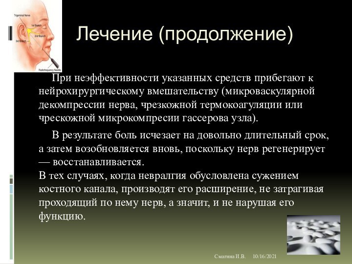 10/16/2021Смагина И.В.Лечение (продолжение)При неэффективности указанных средств прибегают к нейрохирургическому вмешательству (микроваскулярной декомпрессии