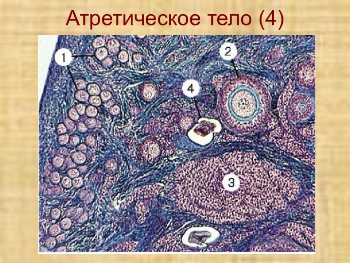 Атретическое тело (4)
