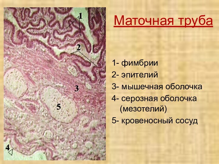 Маточная труба1- фимбрии2- эпителий3- мышечная оболочка4- серозная оболочка (мезотелий)5- кровеносный сосуд