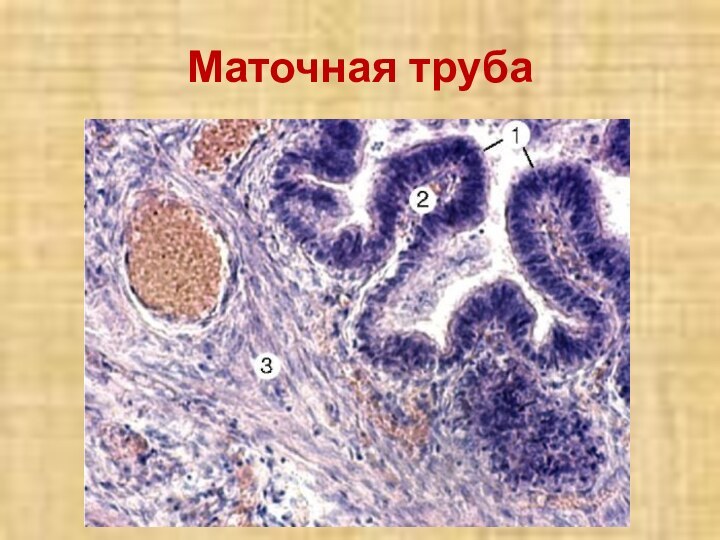 Маточная труба