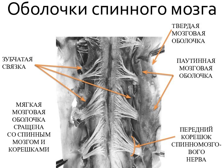 Оболочки спинного мозгаТВЕРДАЯ МОЗГОВАЯ ОБОЛОЧКАПАУТИННАЯ МОЗГОВАЯ ОБОЛОЧКАПЕРЕДНИЙ КОРЕШОК СПИННОМОЗГО-ВОГОНЕРВАЗУБЧАТАЯ СВЯЗКАМЯГКАЯ МОЗГОВАЯ ОБОЛОЧКА