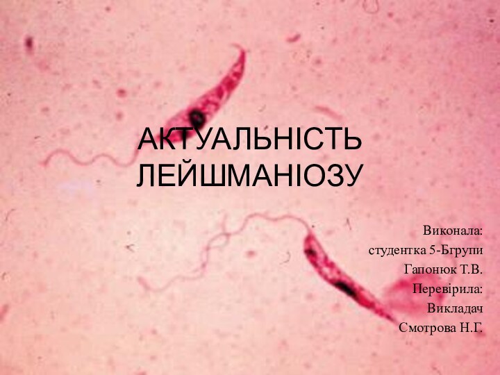 АКТУАЛЬНІСТЬ ЛЕЙШМАНІОЗУВиконала:студентка 5-БгрупиГапонюк Т.В.Перевірила:ВикладачСмотрова Н.Г.