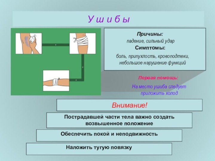 У ш и б ыВнимание!падение, сильный ударПричины:Симптомы:Первая помощь:боль, припухлость, кровоподтеки, небольшое нарушение