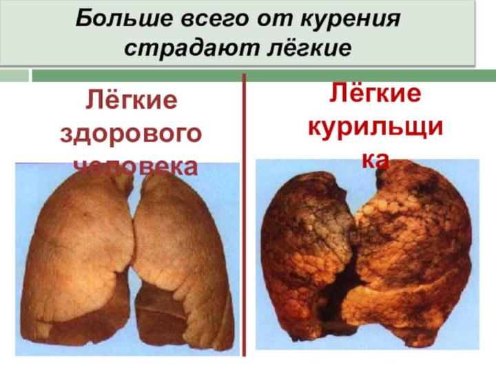 Лёгкие здорового человекаЛёгкие курильщикаБольше всего от курения страдают лёгкие
