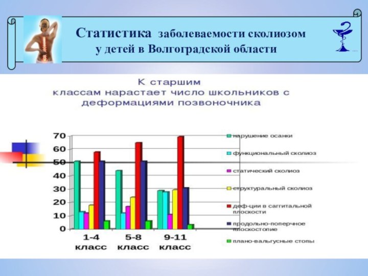 Статистика заболеваемости сколиозом у детей в Волгоградской области