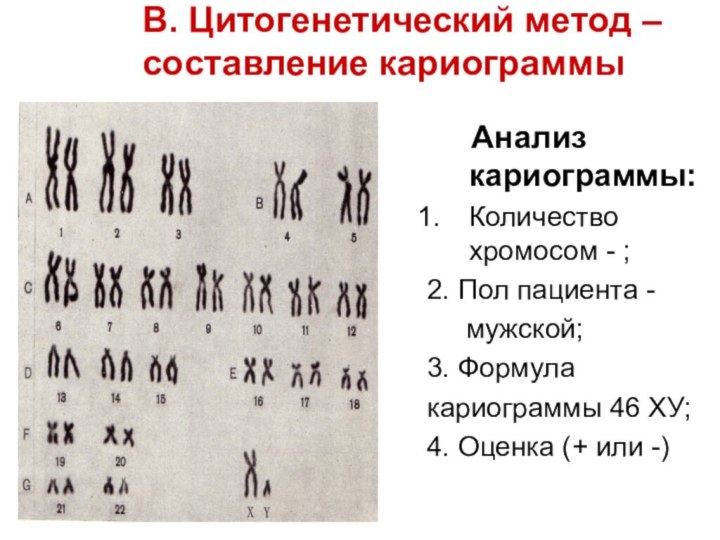 В. Цитогенетический метод –