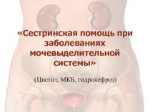 Презентация_Заболевания мочевыделительной системы (цистит, МКБ, гидронефроз)