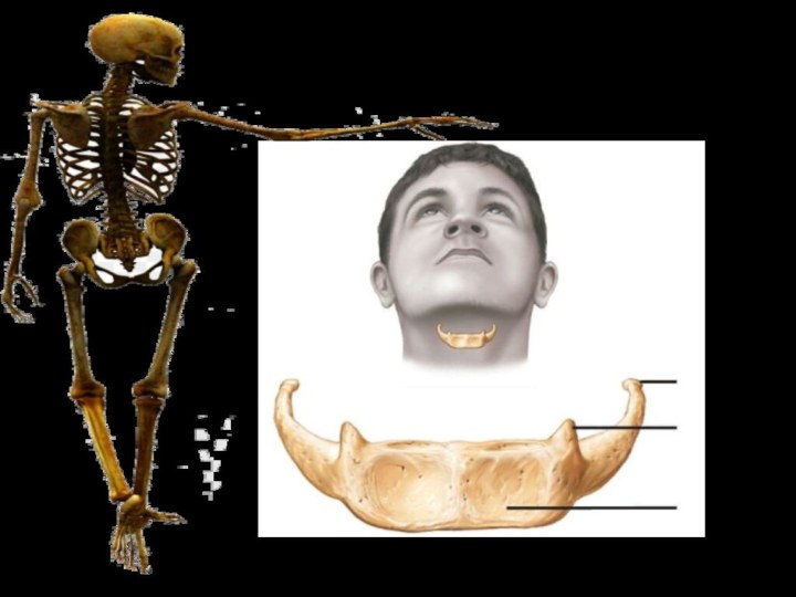 Все кости в теле человека взаимосвязаны, кроме одной - подъязычной  © Fishki.net