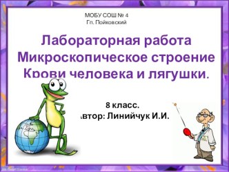 Презентация Лабораторная работа Микроскопическое строение Крови человека и лягушки. (8 класс)