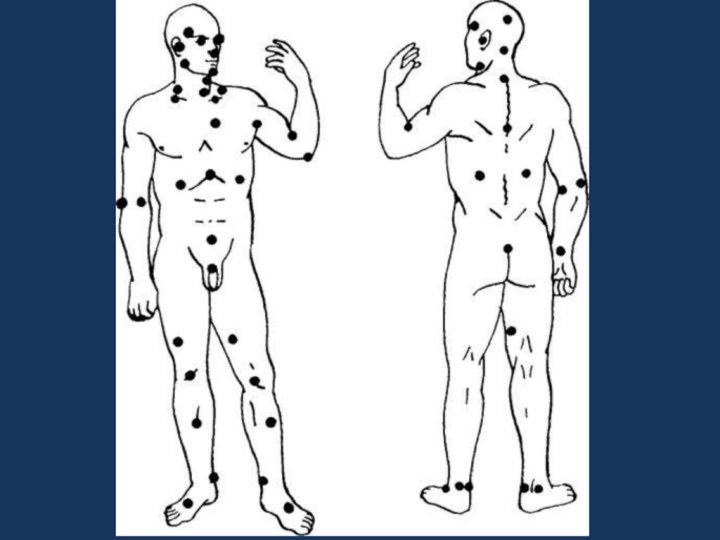 13 точка человека. Слабые точки на теле человека для ударов. Уязвимые болевые точки на теле человека. Болевые точки на теле человека для самообороны.