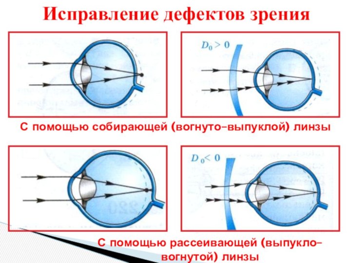 Исправление дефектов зренияС помощью собирающей (вогнуто–выпуклой) линзыС помощью рассеивающей (выпукло–вогнутой) линзы