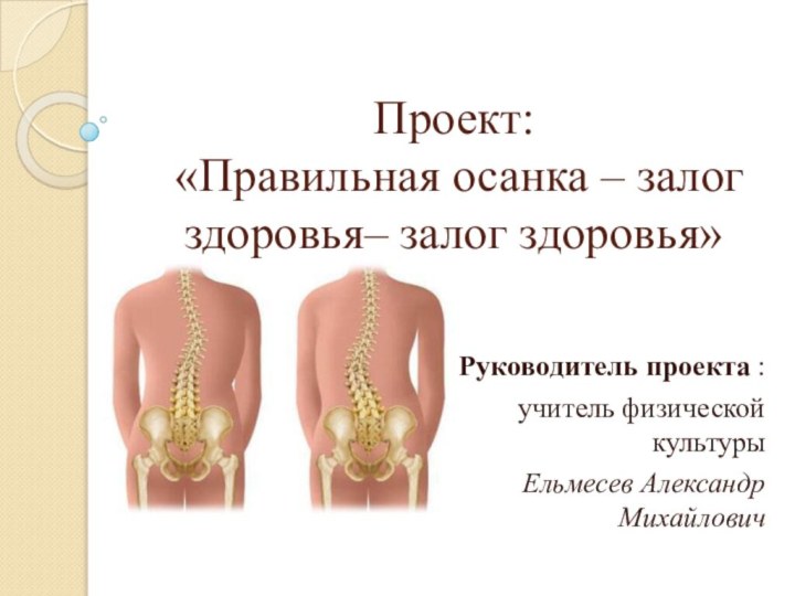 Проект:  «Правильная осанка – залог здоровья– залог здоровья»Руководитель проекта : учитель физической культурыЕльмесев Александр Михайлович