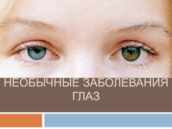 Необычные Заболевания глаз