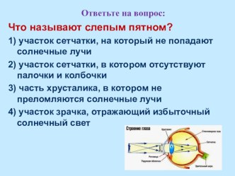 Презентация по биологии на тему Заболевания глаз (8 класс)