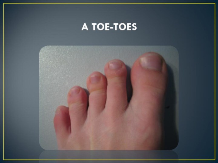 A TOE-TOES