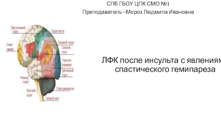 ЛФК после инсульта с явлениями спастического гемипарезаСПб ГБОУ ЦПК СМО №1Преподаватель –Мороз Людмила Ивановна