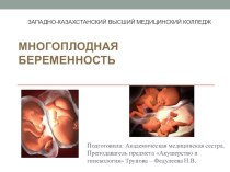 Презентация по предмету Акушерство на тему Многоплодная беременность