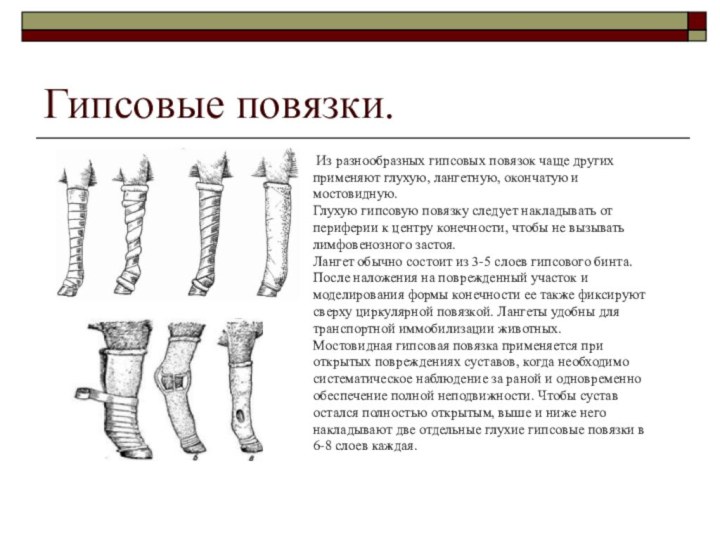 Гипсовые повязки. Из разнообразных гипсовых повязок чаще других применяют глухую, лангетную, окончатую