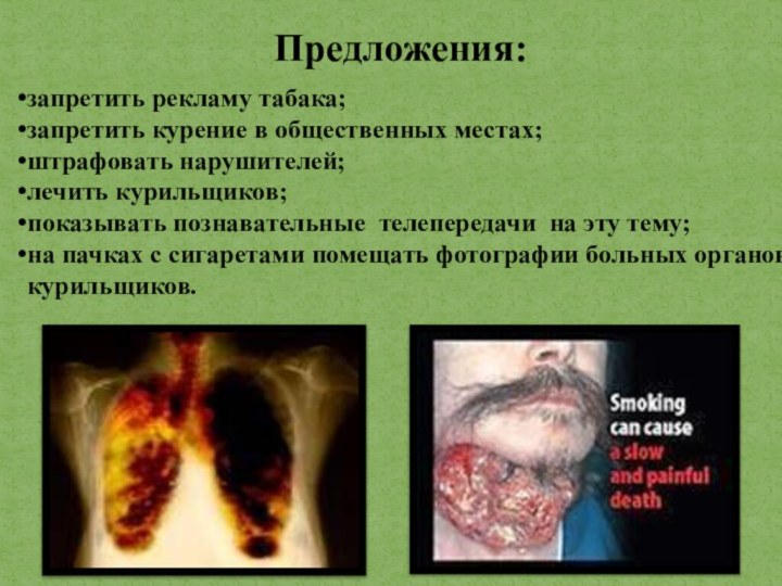 запретить рекламу табака;запретить курение в общественных местах;штрафовать нарушителей;лечить курильщиков;показывать познавательные телепередачи на