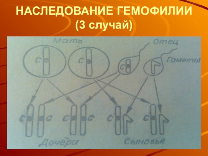 НАСЛЕДОВАНИЕ ГЕМОФИЛИИ (3 случай)