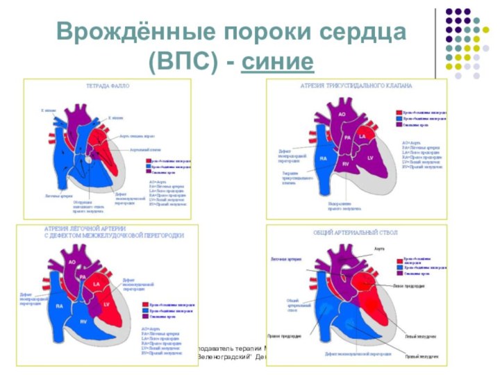 Пороки сердца у детей презентация