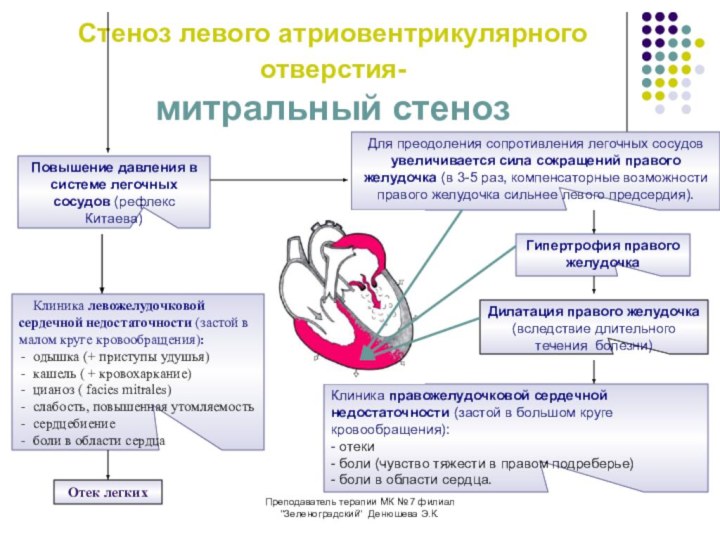 Гемодинамика митральный стеноз схема