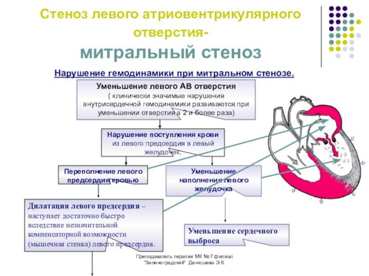 Пороки сердца схема