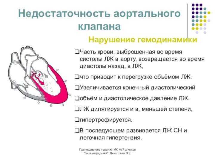 Аортальная сердечная недостаточность. Аортальная недостаточность гемодинамика схема. Гемодинамика недостаточностиклапона аорты. Гемодинамика при недостаточности клапана аорты. Нарушение гемодинамики при аортальной недостаточности.