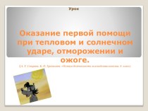 Презентация Оказание первой помощи при солнечном и тепловом ударе, отморожении и ожогах