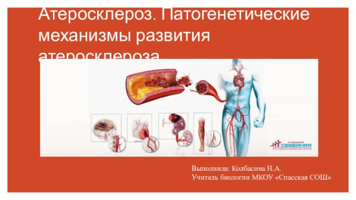 Атеросклероз. Патогенетические механизмы развития атеросклероза.Выполнила: Колбасина Н.А.Учитель биологии МКОУ «Спасская СОШ»