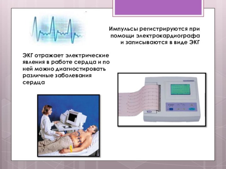 В виде чего регистрируются электрические импульсы сердца