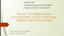 Особенности постановки искусственных зубов в артикуляторе