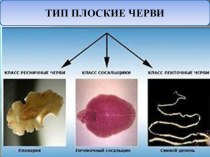 Презентация по биологии на тему Тип Плоские черви