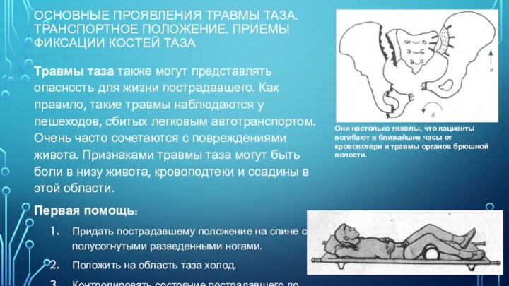 Основные проявления травмы таза. Транспортное положение. Приемы фиксации костей тазаТравмы таза также могут