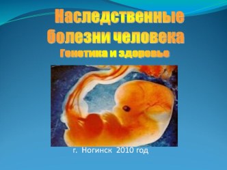 Презентация по биологии на тему Наследственные болезни человека 11 класс