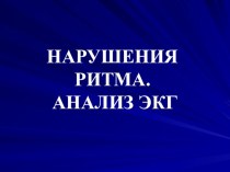 Презентация по ПМ.01. Диагностическая деятельность на тему Нарушения ритма