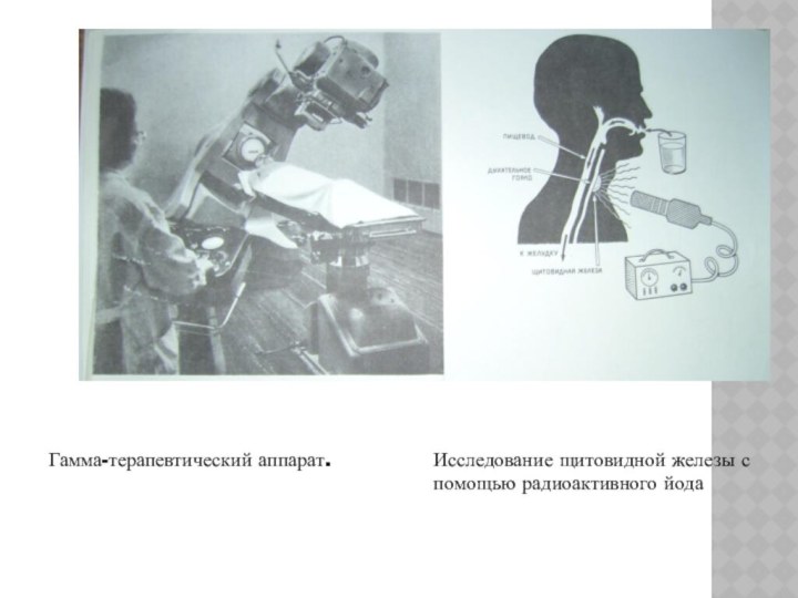 Гамма-терапевтический аппарат.Исследование щитовидной железы с помощью радиоактивного йода