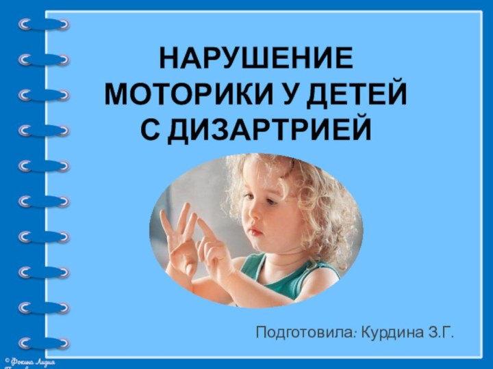 Нарушение моторики у детей с дизартрией Подготовила: Курдина З.Г.