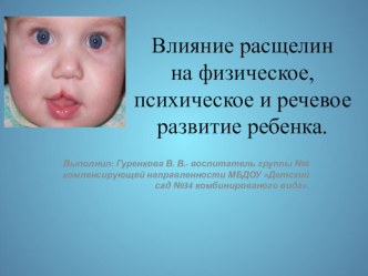 Презентация Влияние расщелин на физическое, психическое и речевое развитие ребенка. презентация