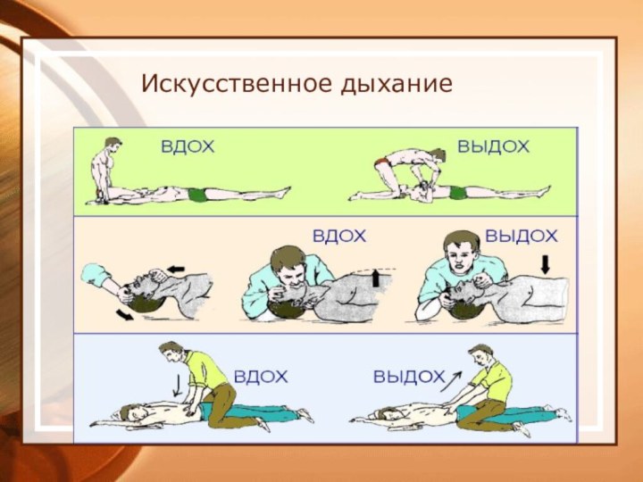 Искусственное дыхание