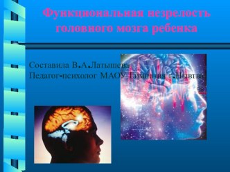 Минимальные мозговые дисфункции учеников, способы коррекции. презентация по теме